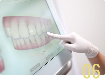 治療完了・保定期間