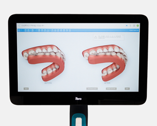 型取りの時間を大幅に短縮
